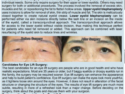 Eye Lift Surgery (Blepharoplasty)